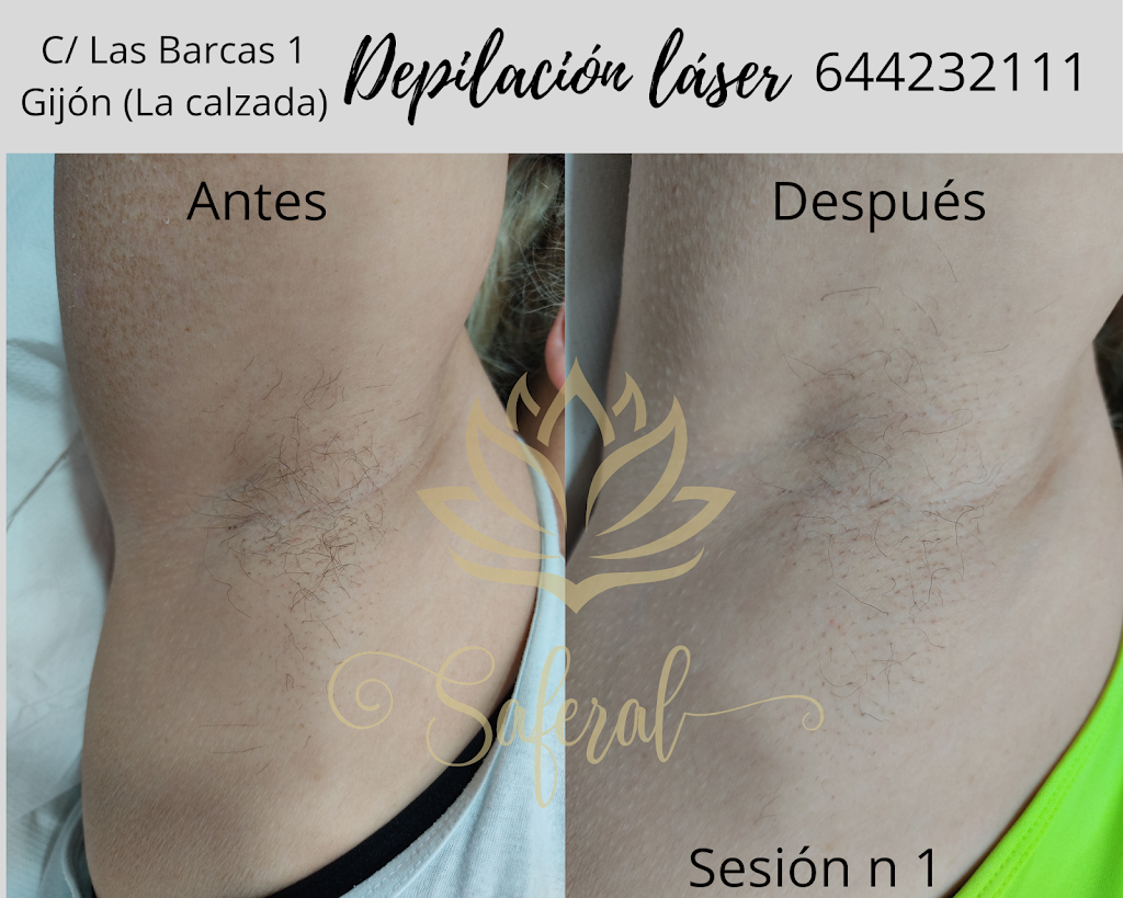 Saferal | Centro Estetica Depilacion Laser Gijon