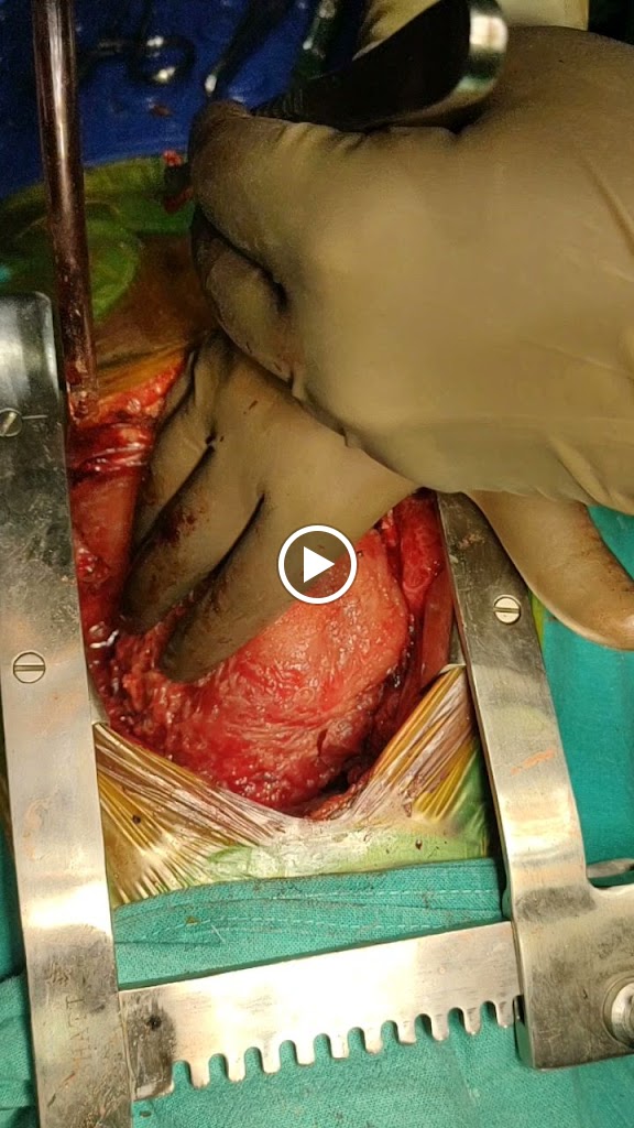 Dr. Dr Nm Gaikwad Cardiovascular And Thoracic Surgeon