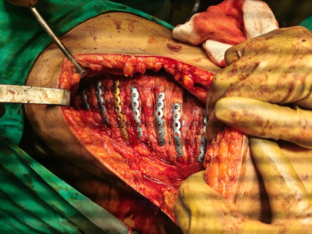 Dr. Dr Arun Kumar Haridas Best Cardiologist Kalaburagi Best Heart Vascular Lung Surgeon Best Pulmonologist Kalaburagi