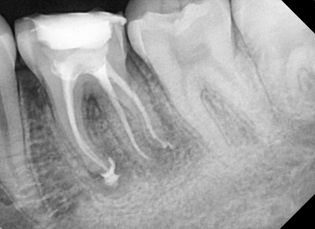 X-ray
