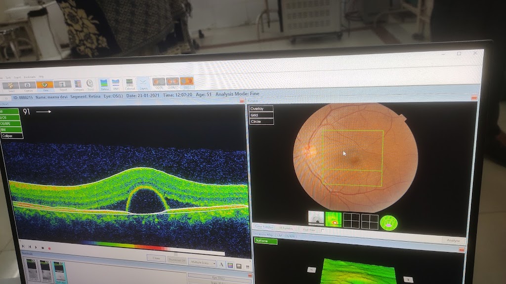 Prasad Eye Care