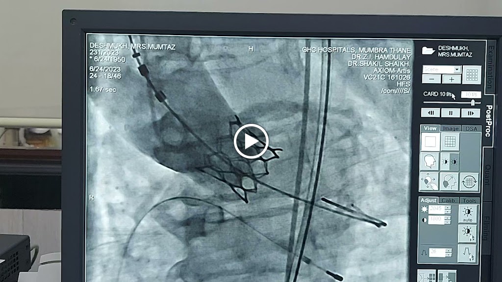 Dr. Dr Shakil Shaikh Heart Care Super Speciality Clinic Best Cardiologist In Kalyan 2D Echo Angiography Angioplasty