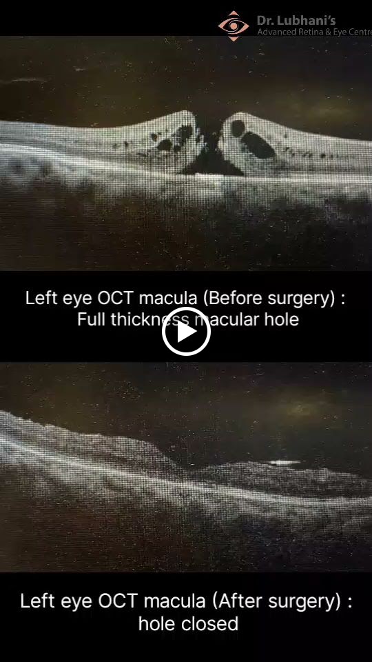 Videos