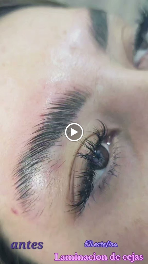 eli.estetica — Videos