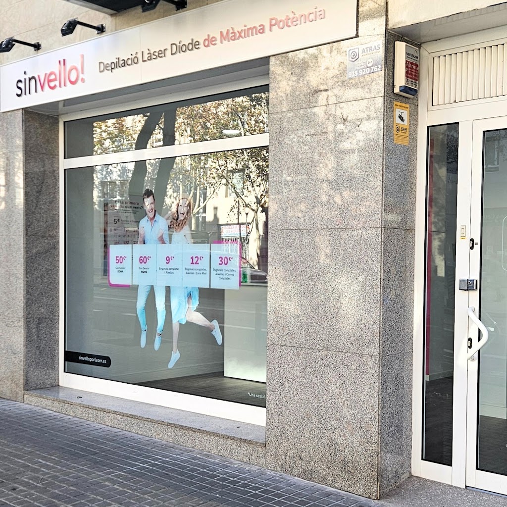 SinVello! Sabadell | Depilacion Laser Diodo