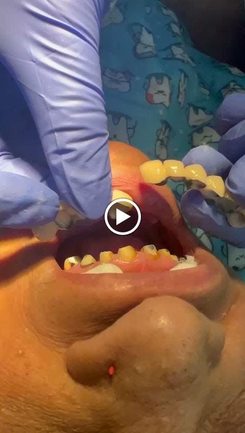 Tooth