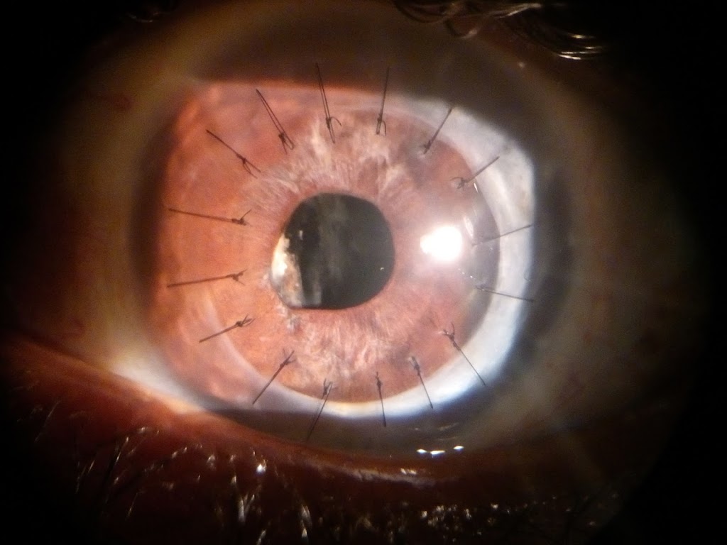Dr Prashant Bhartiya Best Eye Care Center With Cornea Cataract Retina And Pediatric Ophthalmology Specialist
