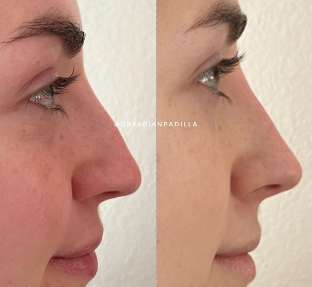 Medicina Estetica con Dr. Fabian Padilla