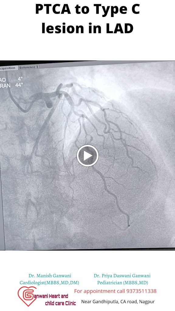 Dr. Ganwani Heart Care Clinic Dr Manish Ganwani Cardiologist Nagpur