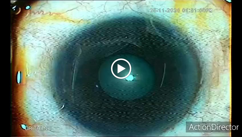 Videos