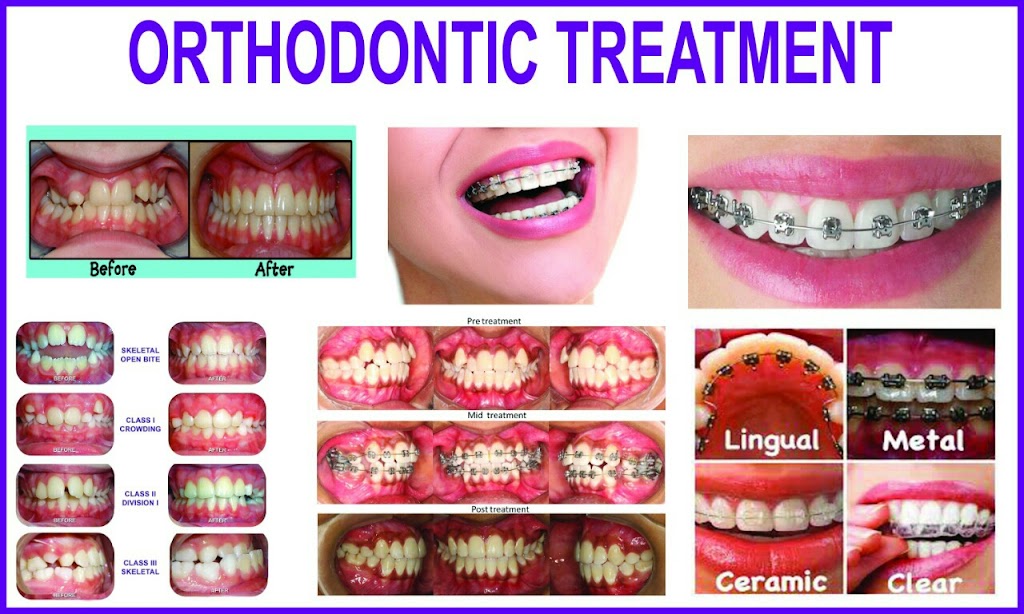 Tooth