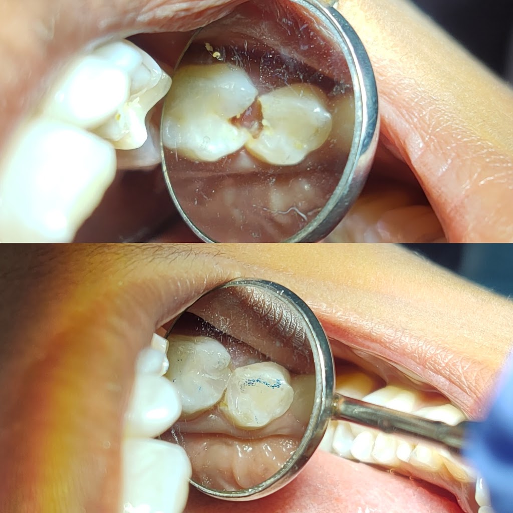 Tooth