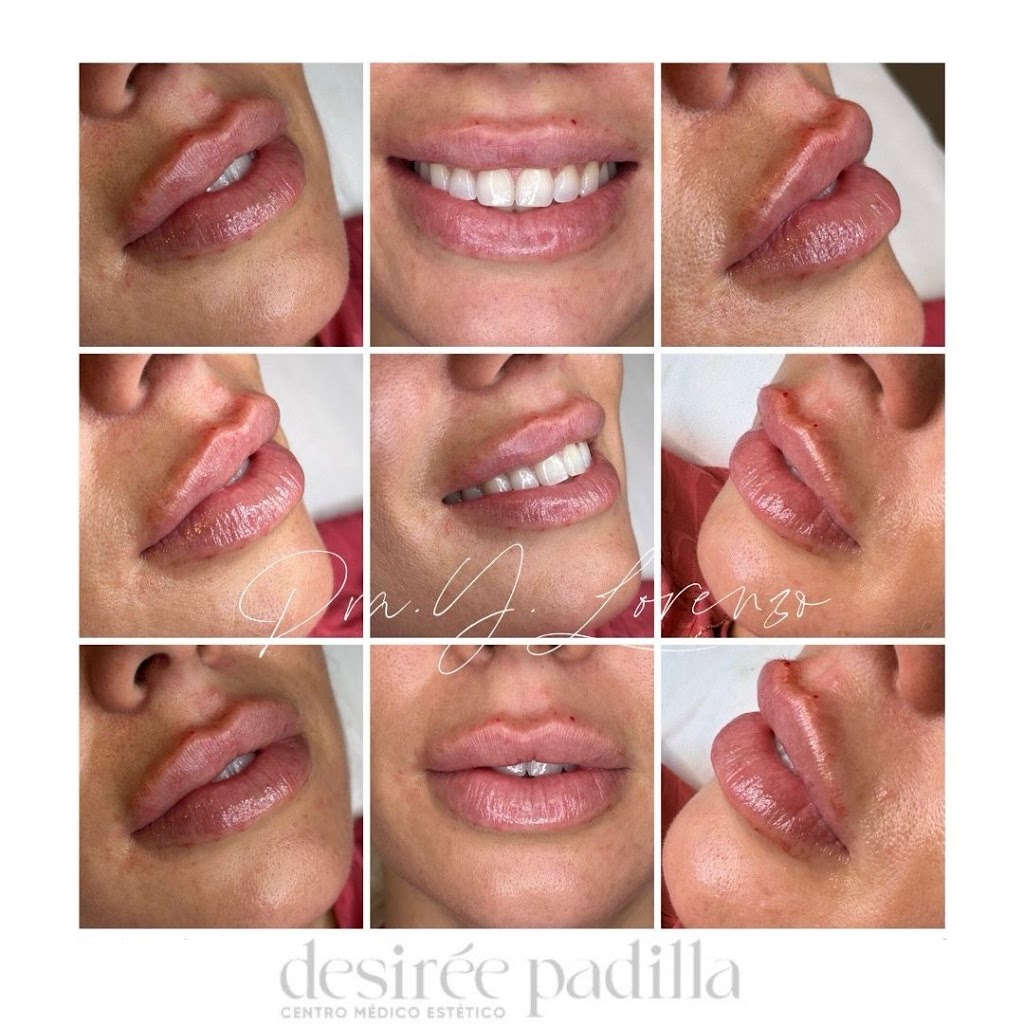 DESIREE PADILLA CENTRO MEDICO ESTETICO