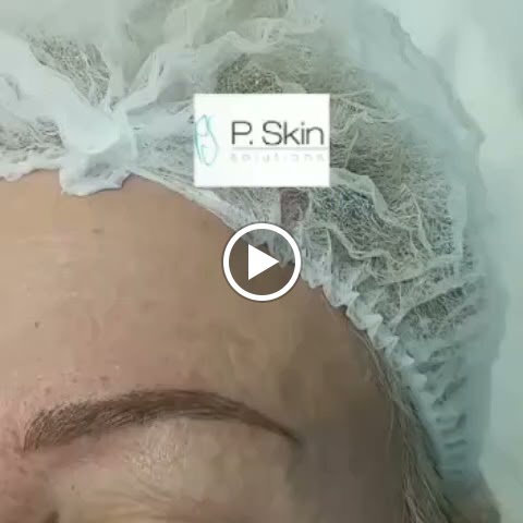 Centro Estetica P. Skin Solutions — Videos