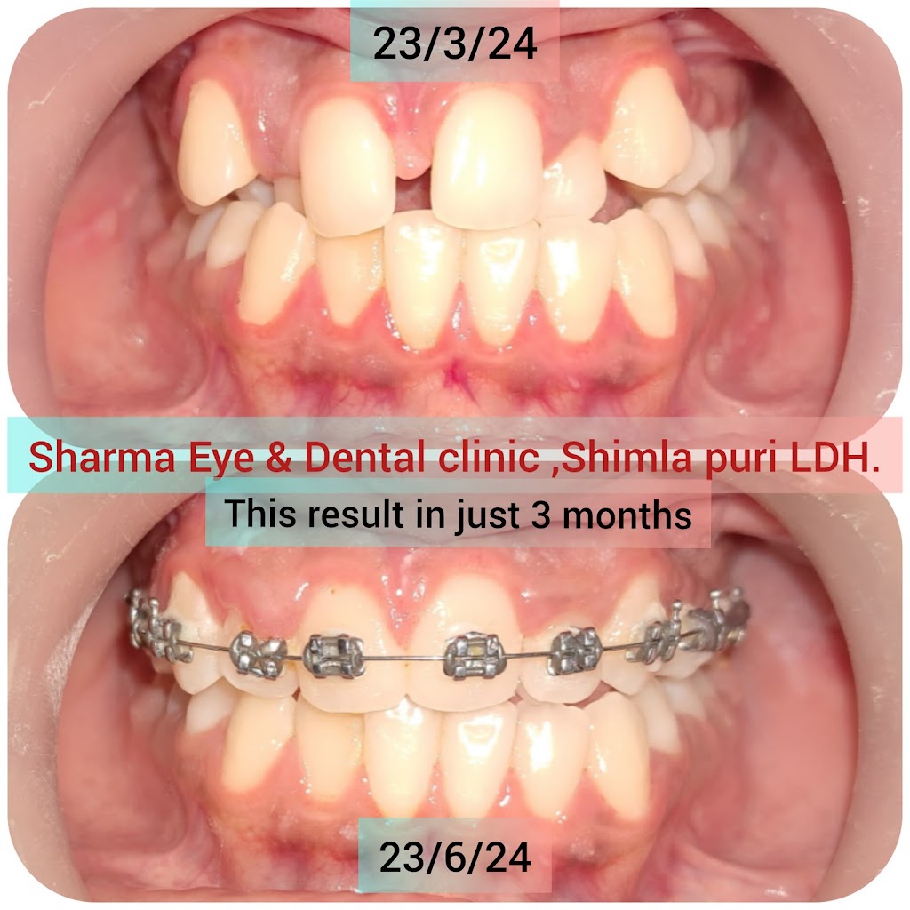 Sharma Eye Care Opticals