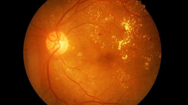 Saanvi Eye Clinic