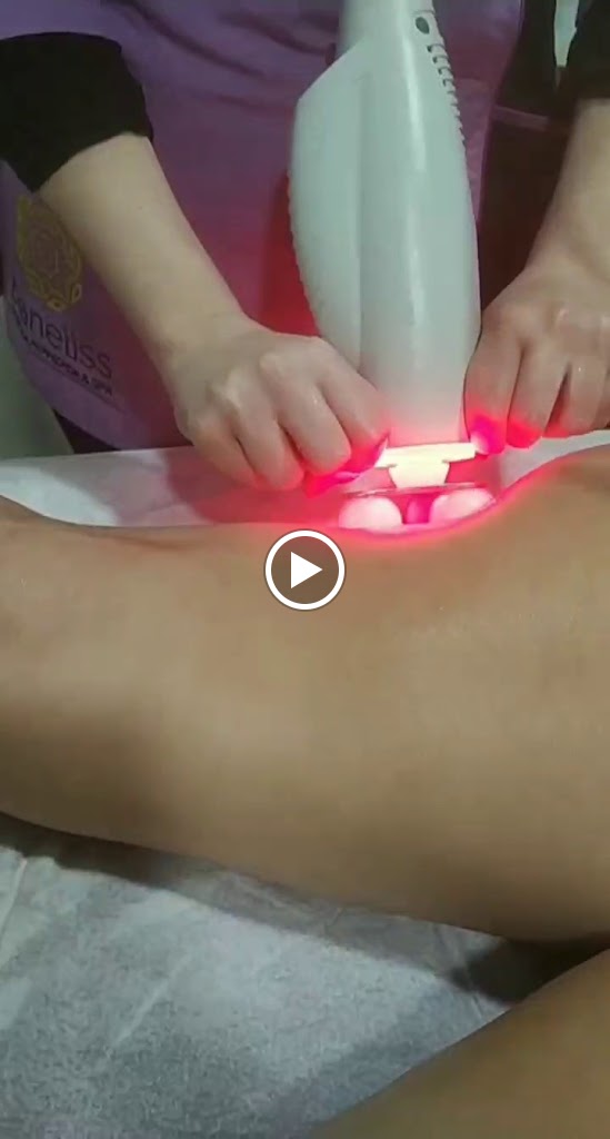 Microblading La Roda - Plasmapen La Roda- Blaneliss Estetica Avanzada — Del propietario