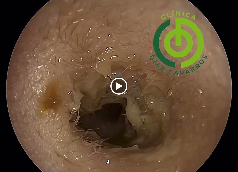 Clinica Diaz Caparros Audicion y Medicina Estetica