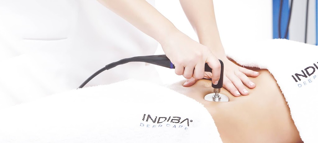 E. Crespo | Estetica con radiofrecuencia Indiba