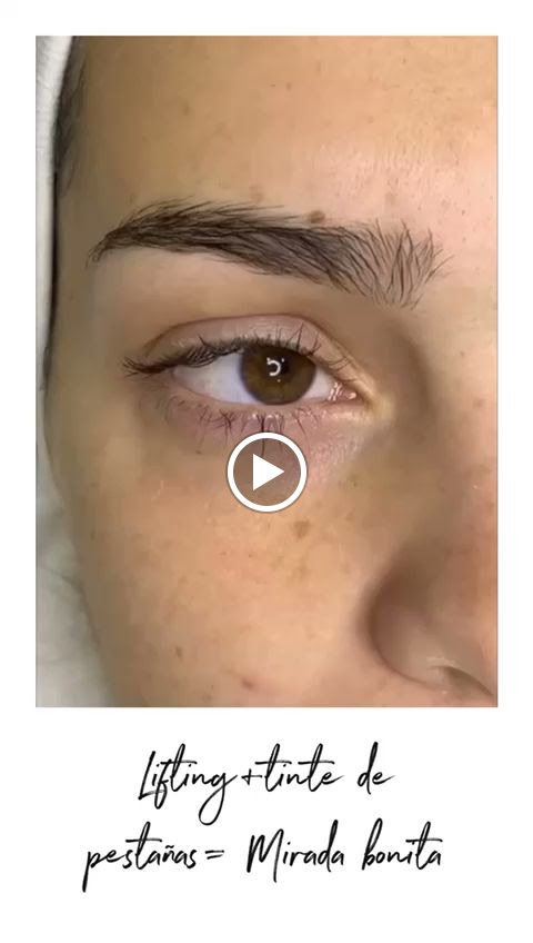 dermica centro medico estetico — Videos