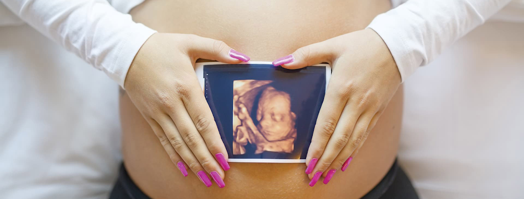 At First Glance 3D/4D Ultrasound