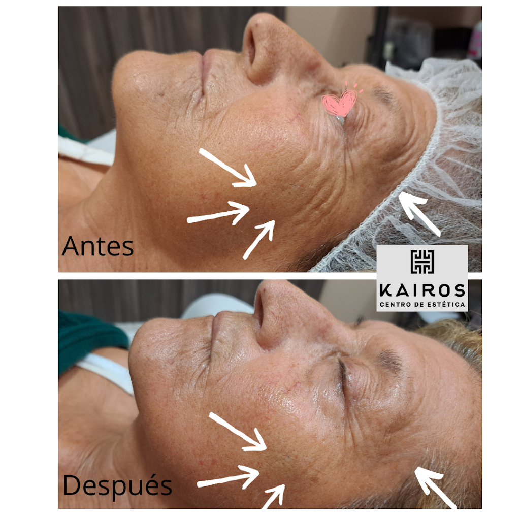 Kairos Centro de Estetica — Mas recientes