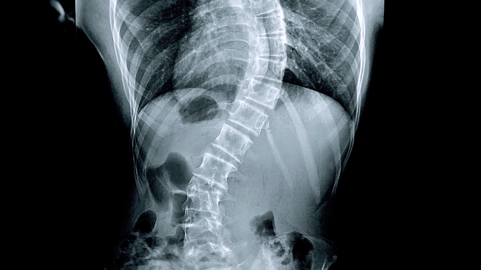 Dr. Dr Ranjith Unnikrishnan Orthopedic And Spine Specialist In Thiruvananthapuram Kerala