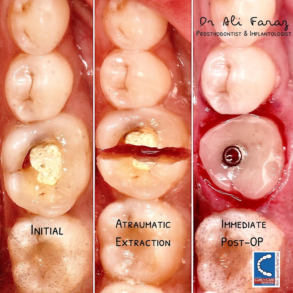 Dr Ali Faraz’s Cure`n`Care Dental Clinic & Implant Centre