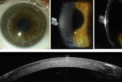 Kanha Eye Care Centre