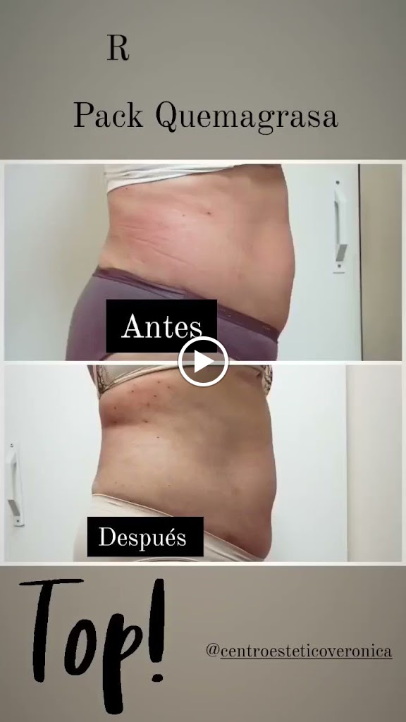 B&B Center Estetica avanzada (Mislata) — Del propietario