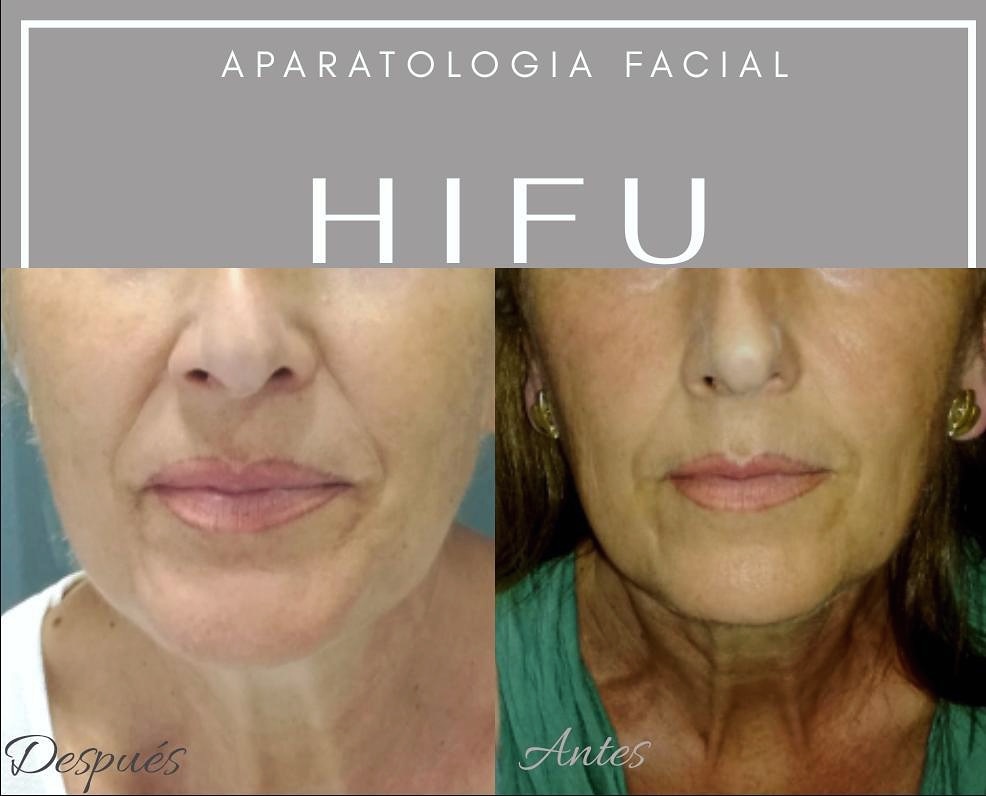 Look esthetic centro de estetica en Gava aparatologia y bienestar — Del propietario