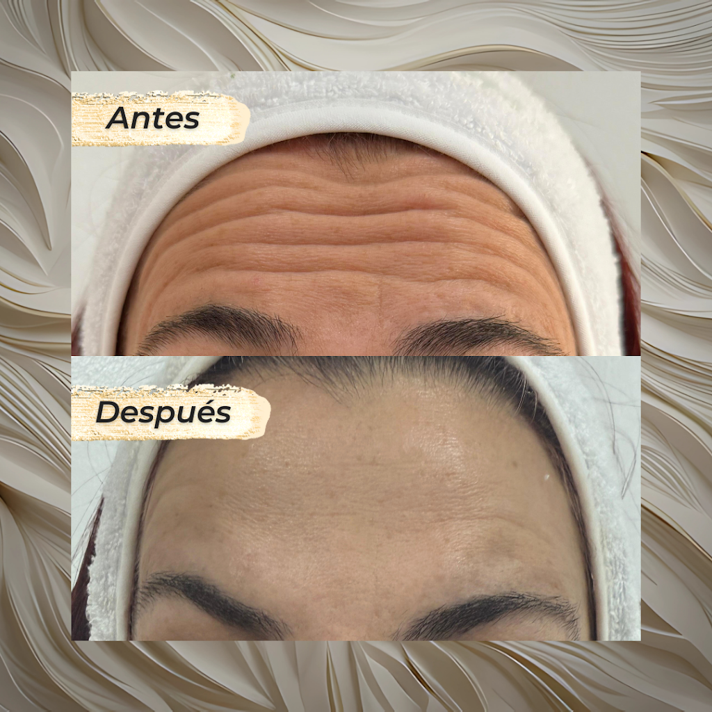 Clinica FESTIC - Medicina estetica avanzada — Mas recientes