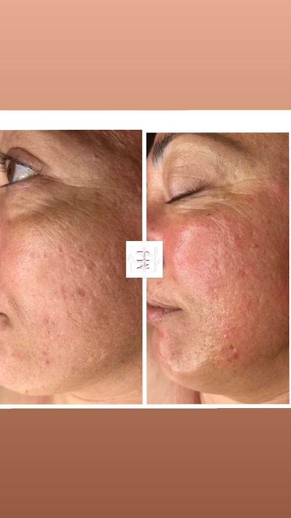 Centro Estetica MARIA JOSE QUIROS | Clinica Estetica Avanzada — Mas recientes