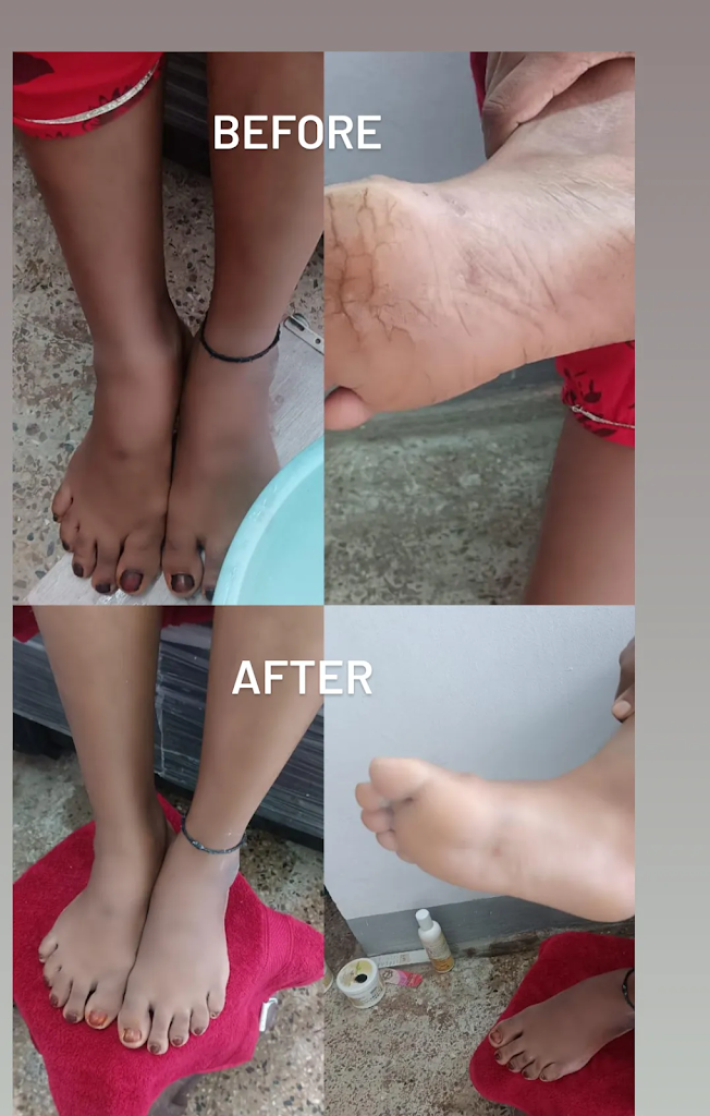 Renuka S At Home Beauty Services For Ladies