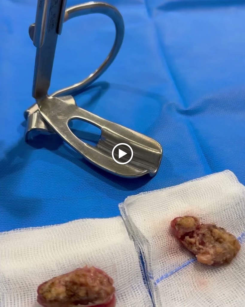 Clinica Diaz Caparros Audicion y Medicina Estetica — Videos