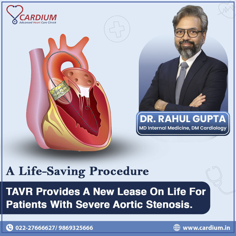 Dr. Cardium Heart Care Clinic Heart Specialist Cardiologist In Kharghar Raigad