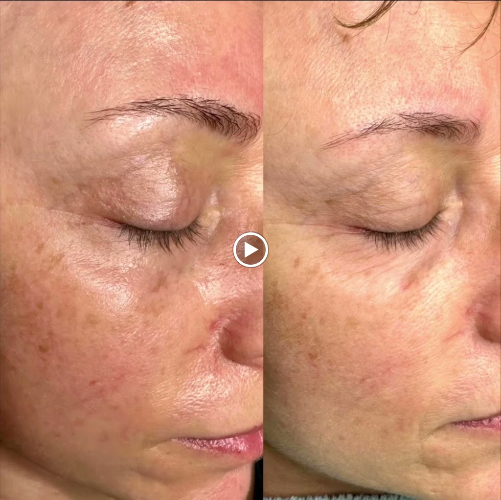 Centro de Estetica Yulia Nayade — Videos