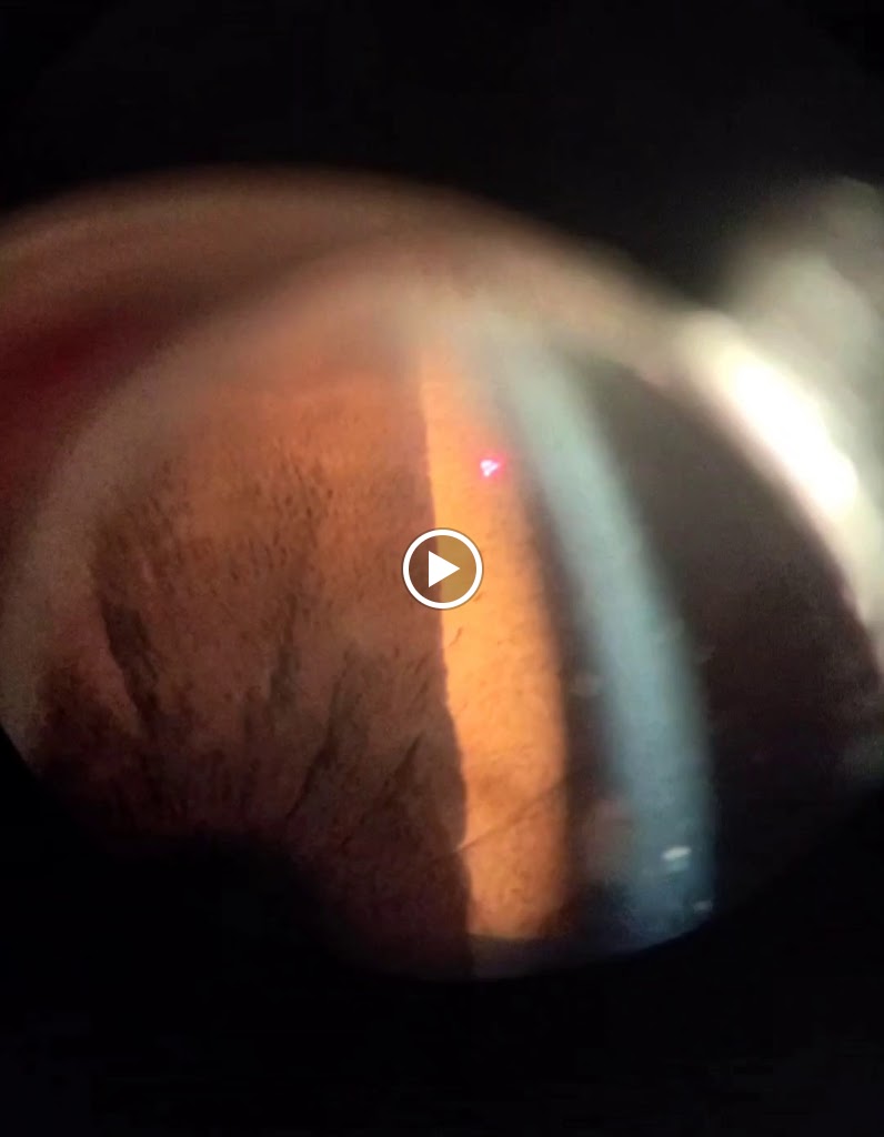 Videos