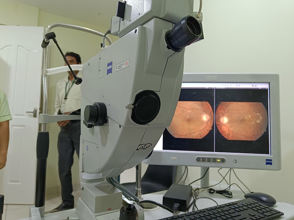 Sreenethra Eye Care Trivandrum