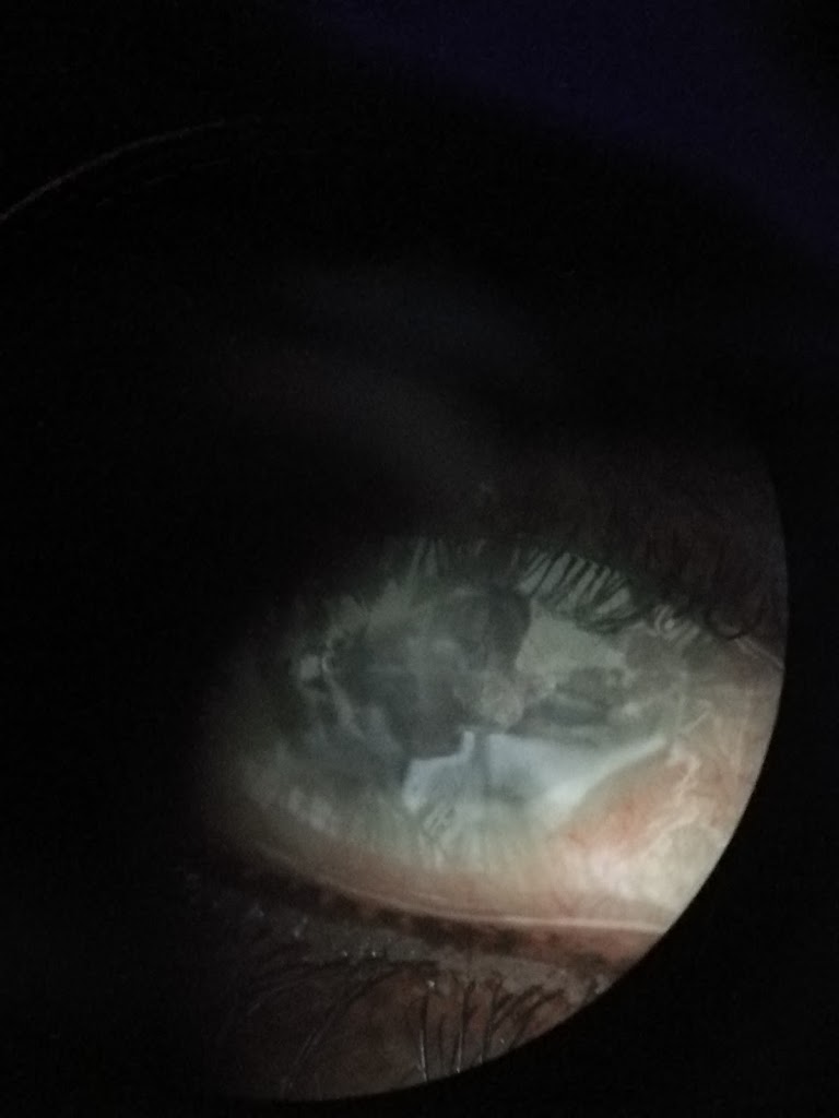 Dry Eye Center