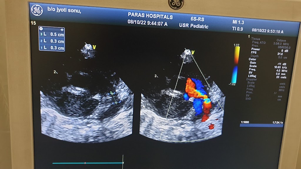 Dr. Child Cardiac Care Dr Deepak Thakur