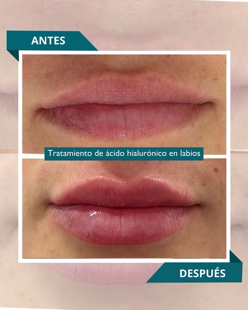 Dr. Manuel Rubio - Medicina Estetica Calella — Mas recientes