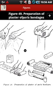 Bandaging and Splinting Screenshots 7