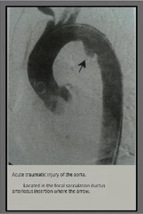 Radiology radiographs of exams(圖2)-速報App