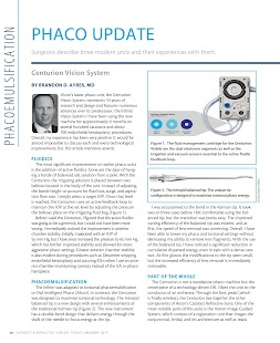 Cataract & Refractive Surgery Screenshots 7