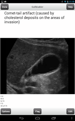 免費下載教育APP|ARDMS Ultrasound Flashcards Lt app開箱文|APP開箱王