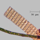Small Colonial Diatom