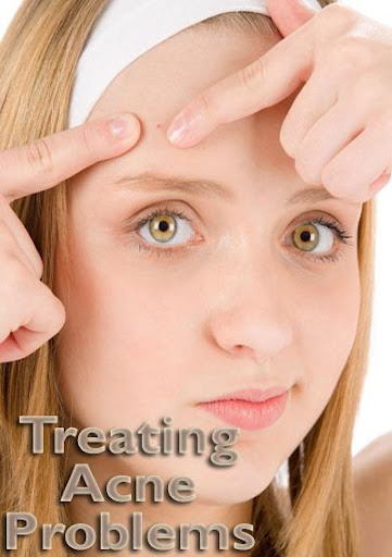 Treating Acne Problems