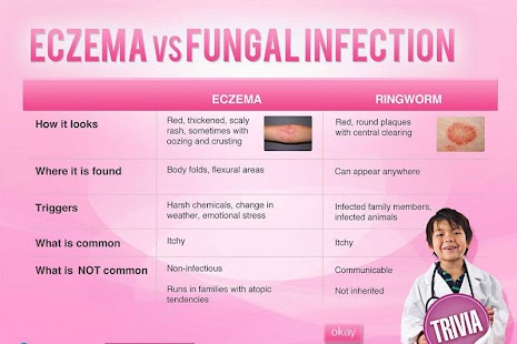 How to mod Eczema Quiz 1.0.0 unlimited apk for pc