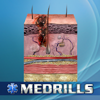 Medrills: Soft-Tissue Trauma APK 电影海报图片